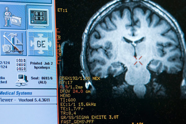 brain-scan-image-monk-WEB